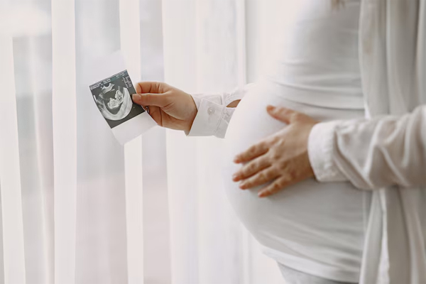 Antenatal Surveillance